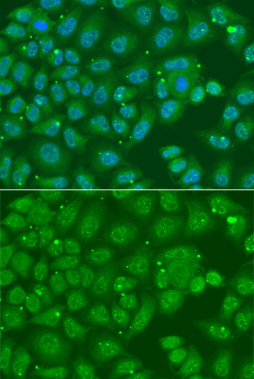 ANXA8L1 Antibody in Immunocytochemistry (ICC/IF)