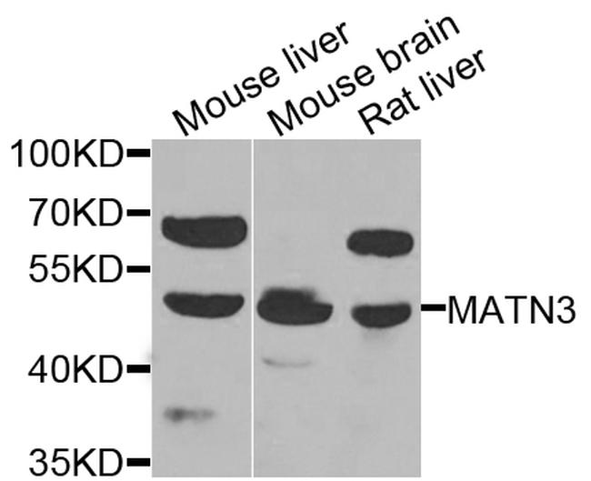 MATN3 Antibody in Western Blot (WB)