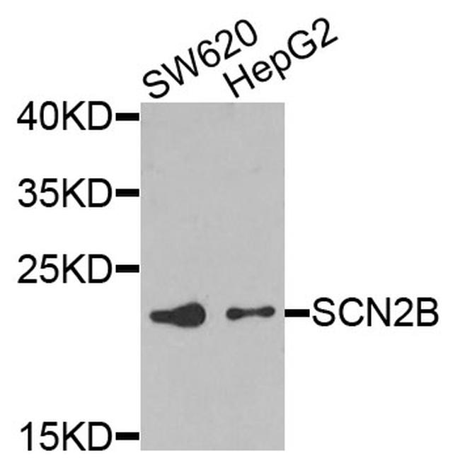 SCN2B Antibody in Western Blot (WB)
