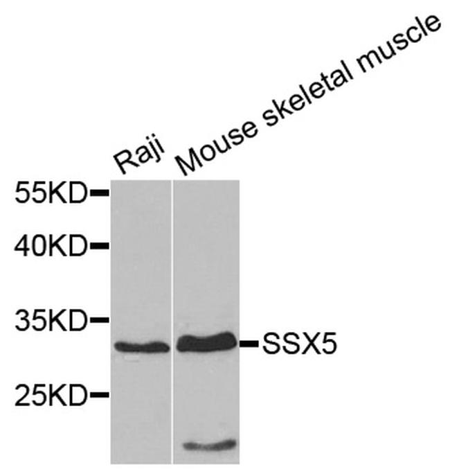 SSX5 Antibody in Western Blot (WB)