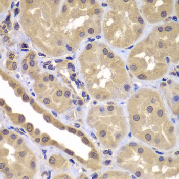 BAG2 Antibody in Immunohistochemistry (Paraffin) (IHC (P))