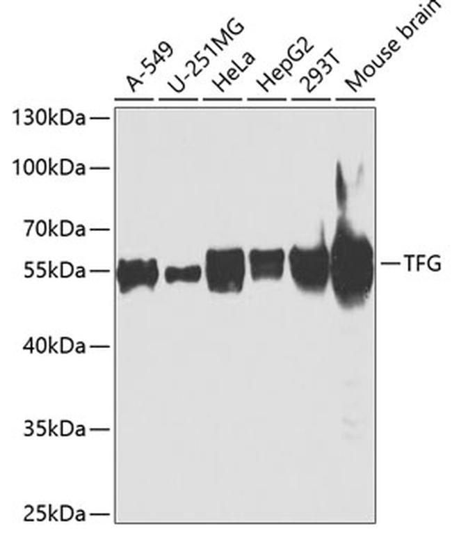 TRK fused gene Antibody in Western Blot (WB)