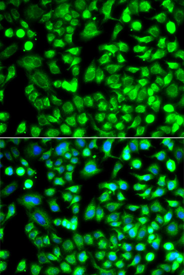 ALKBH4 Antibody in Immunocytochemistry (ICC/IF)