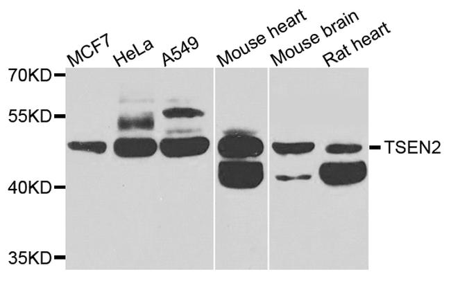 TSEN2 Antibody in Western Blot (WB)