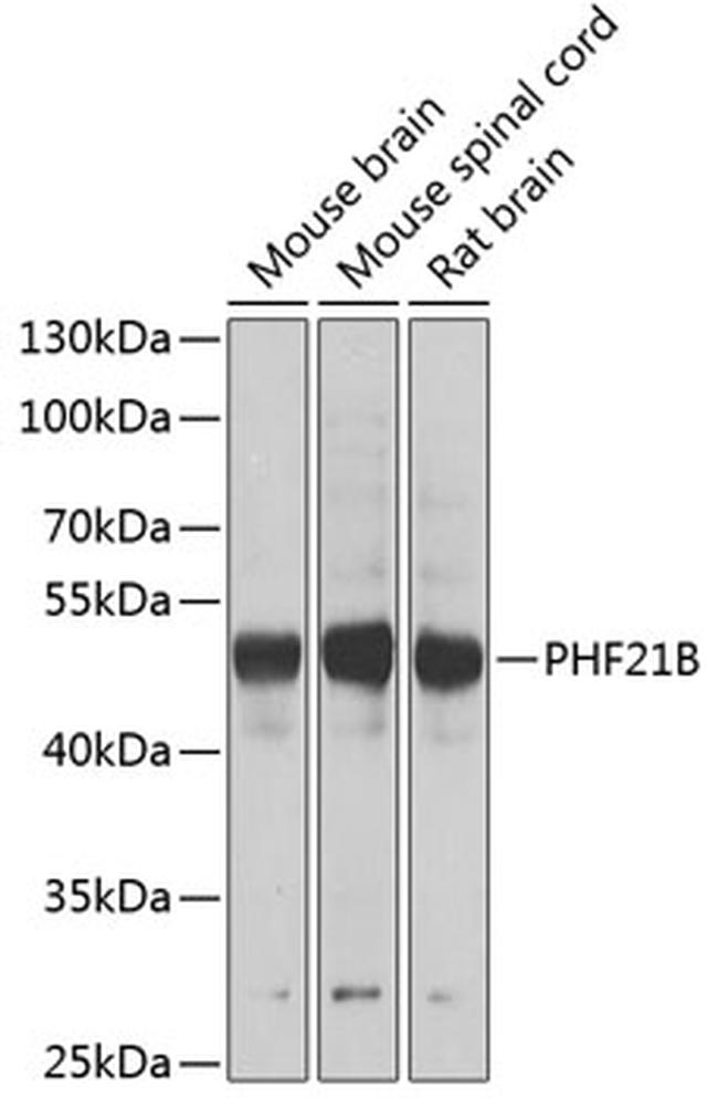 PHF21B Antibody in Western Blot (WB)