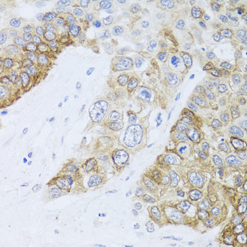CHD1 Antibody in Immunohistochemistry (Paraffin) (IHC (P))