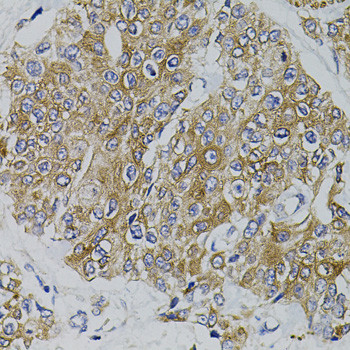 ARHGEF11 Antibody in Immunohistochemistry (Paraffin) (IHC (P))