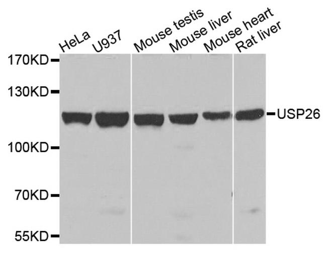 USP26 Antibody in Western Blot (WB)