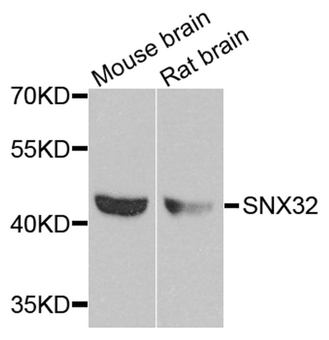 SNX32 Antibody in Western Blot (WB)