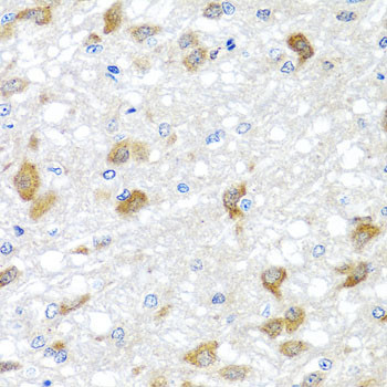 PIP4K2B Antibody in Immunohistochemistry (Paraffin) (IHC (P))