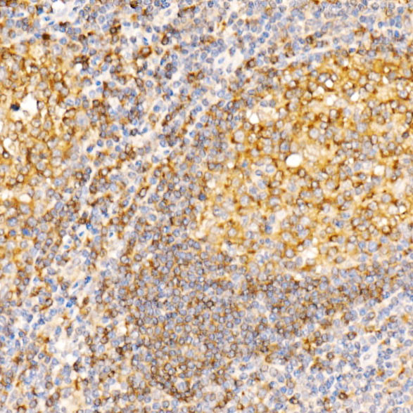 STX7 Antibody in Immunohistochemistry (Paraffin) (IHC (P))