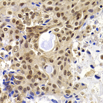 PHF19 Antibody in Immunohistochemistry (Paraffin) (IHC (P))