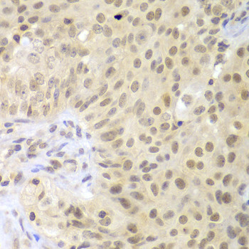LHX4 Antibody in Immunohistochemistry (Paraffin) (IHC (P))