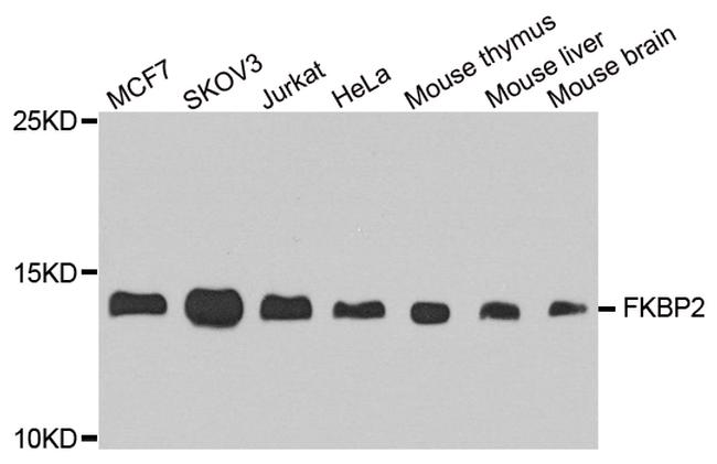 FKBP2 Antibody in Western Blot (WB)