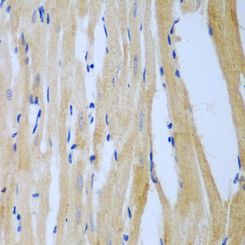 MGAT3 Antibody in Immunohistochemistry (Paraffin) (IHC (P))