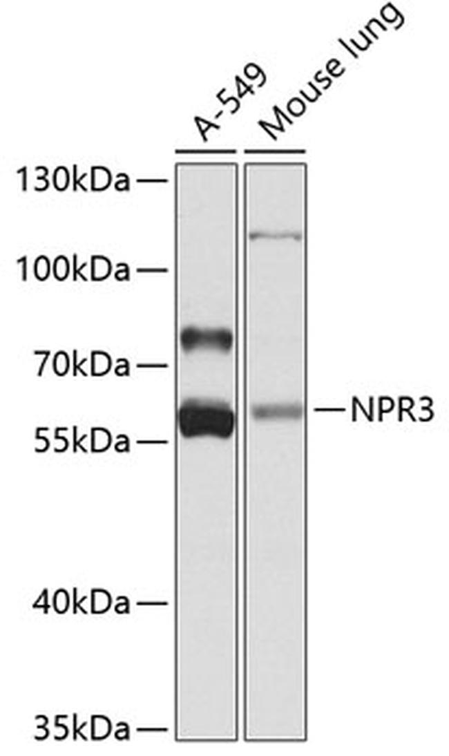 NPR3 Antibody in Western Blot (WB)