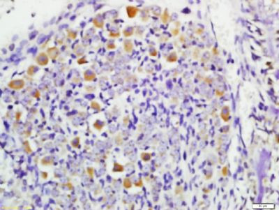 STK38 Antibody in Immunohistochemistry (Paraffin) (IHC (P))