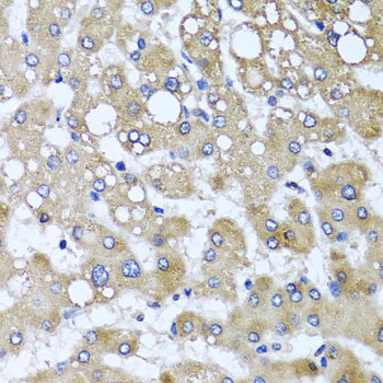 TTLL12 Antibody in Immunohistochemistry (Paraffin) (IHC (P))