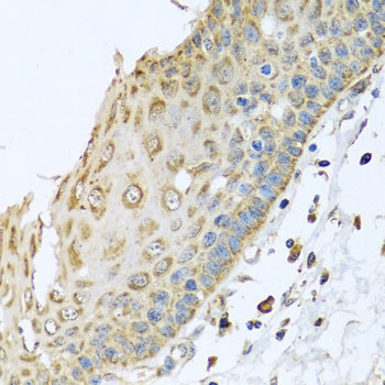 ARFGAP3 Antibody in Immunohistochemistry (Paraffin) (IHC (P))