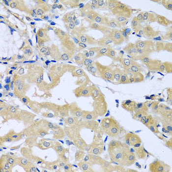HS1BP3 Antibody in Immunohistochemistry (Paraffin) (IHC (P))