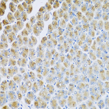 AP1M2 Antibody in Immunohistochemistry (Paraffin) (IHC (P))