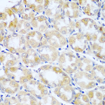 ANR52 Antibody in Immunohistochemistry (Paraffin) (IHC (P))