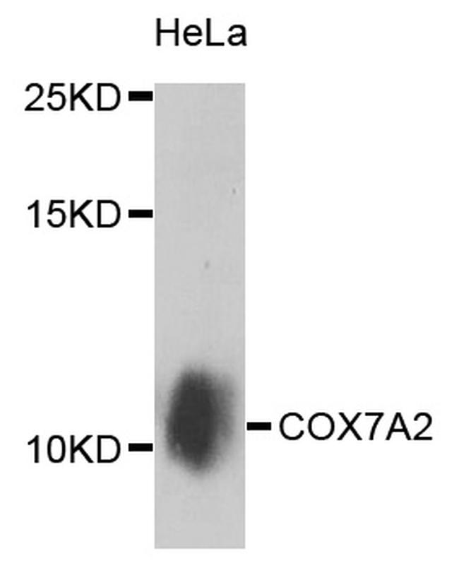 COX7A2 Antibody in Western Blot (WB)