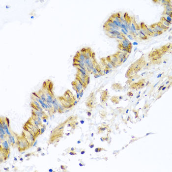 PCDHA12 Antibody in Immunohistochemistry (Paraffin) (IHC (P))