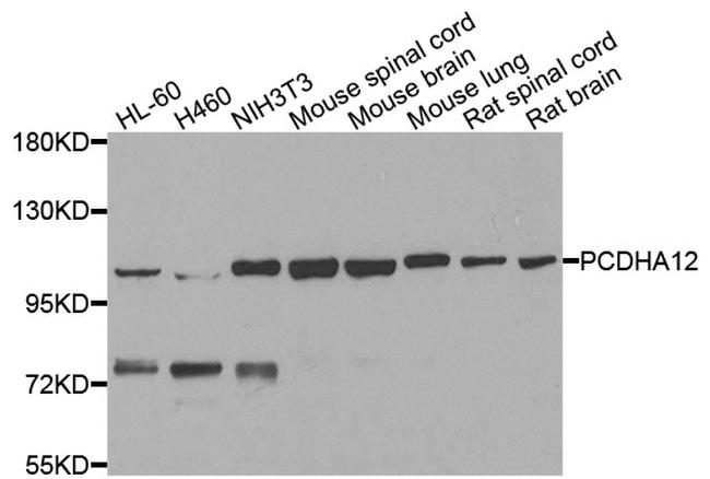 PCDHA12 Antibody in Western Blot (WB)