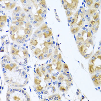 TMEM43 Antibody in Immunohistochemistry (Paraffin) (IHC (P))