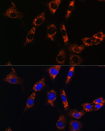 Aquaporin 8 Antibody in Immunocytochemistry (ICC/IF)
