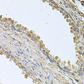 MEMO1 Antibody in Immunohistochemistry (Paraffin) (IHC (P))