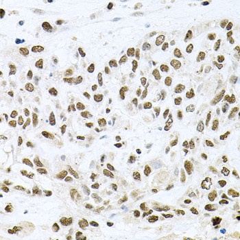BCCIP Antibody in Immunohistochemistry (Paraffin) (IHC (P))