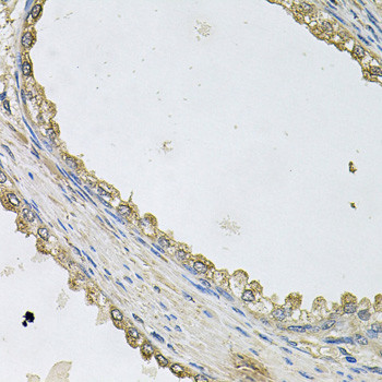 MTERFD1 Antibody in Immunohistochemistry (Paraffin) (IHC (P))