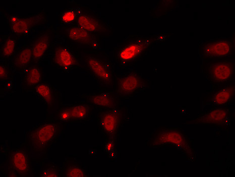 hnRNP F Antibody in Immunocytochemistry (ICC/IF)