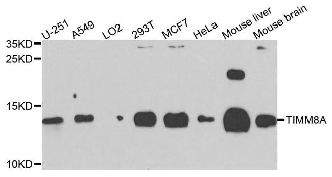 TIMM8A Antibody in Western Blot (WB)