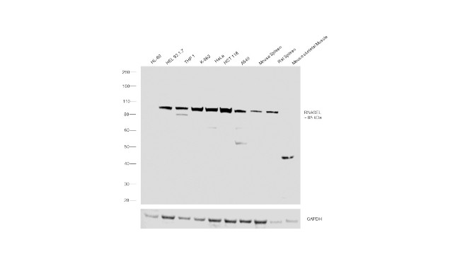 RNaseL Antibody in Western Blot (WB)