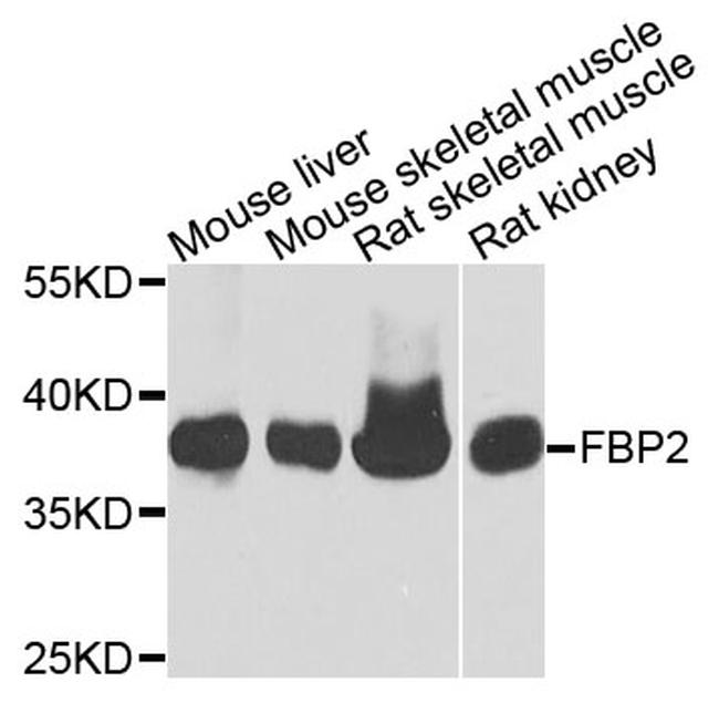 FBP2 Antibody in Western Blot (WB)