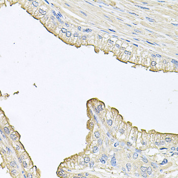 FABP12 Antibody in Immunohistochemistry (Paraffin) (IHC (P))