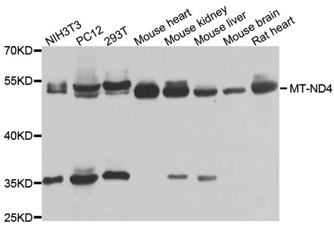 MT-ND4 Antibody in Western Blot (WB)