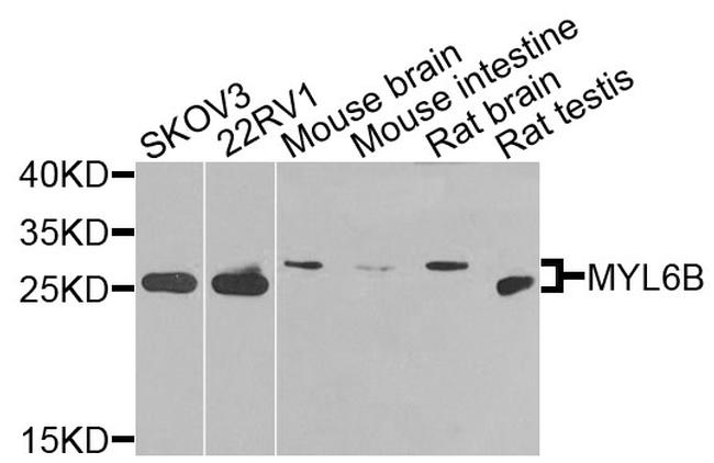 MYL6B Antibody in Western Blot (WB)