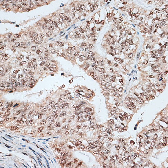 RBM17 Antibody in Immunohistochemistry (Paraffin) (IHC (P))