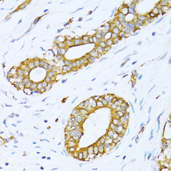 VARS Antibody in Immunohistochemistry (Paraffin) (IHC (P))