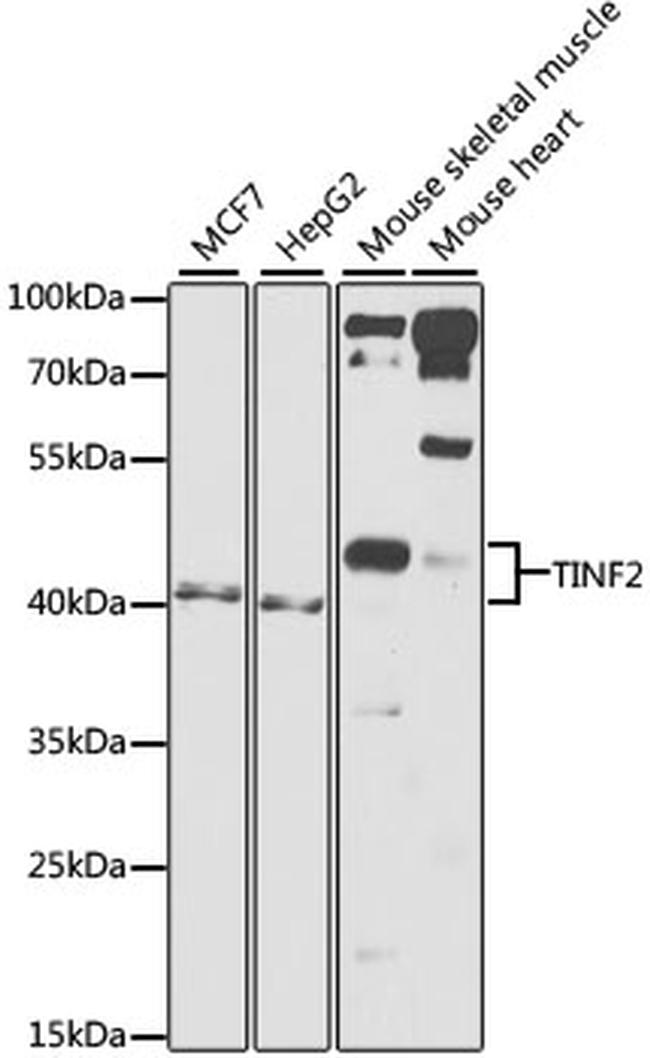 TIN2 Antibody in Western Blot (WB)