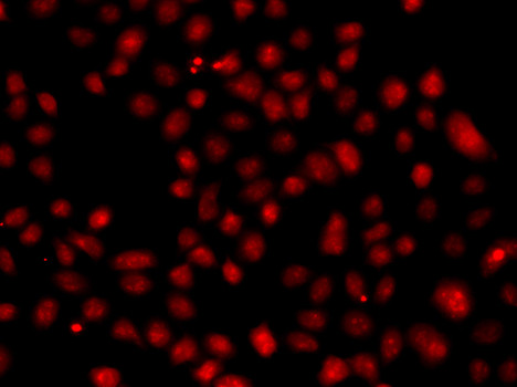 FBXW11 Antibody in Immunocytochemistry (ICC/IF)