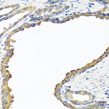 NYX Antibody in Immunohistochemistry (Paraffin) (IHC (P))