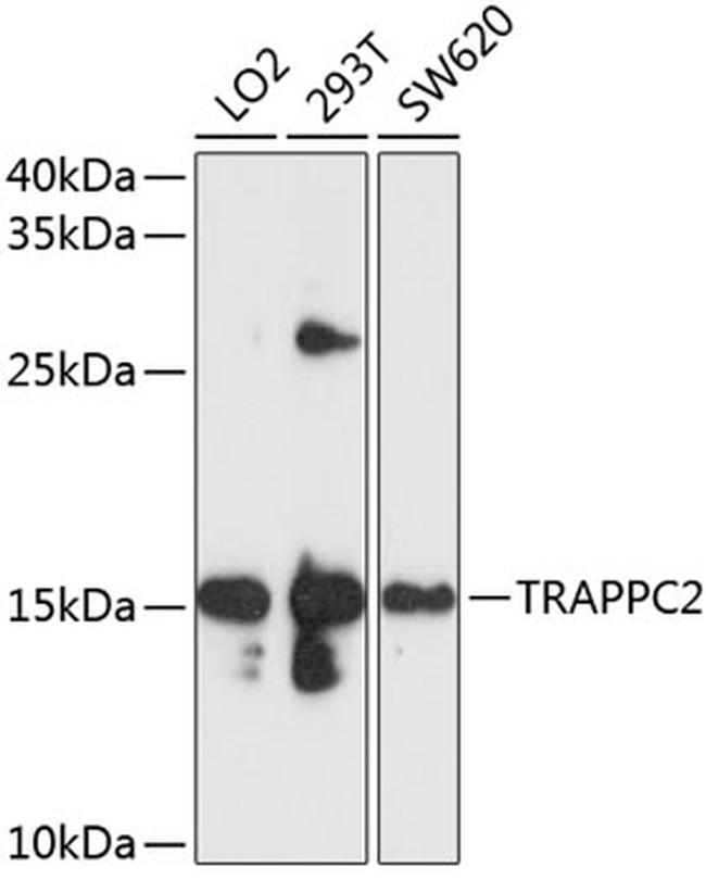 TRAPPC2 Antibody in Western Blot (WB)