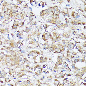 MTHFD2 Antibody in Immunohistochemistry (Paraffin) (IHC (P))