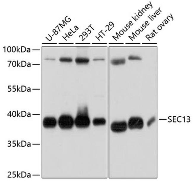SEC13 Antibody in Western Blot (WB)
