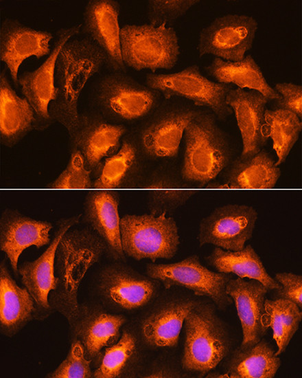 SEC11A Antibody in Immunocytochemistry (ICC/IF)